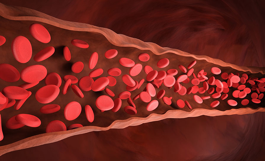 Prevention and management of venous thromboembolism - Med iLearning